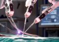 5G, PRIMA OPERAZIONE CHIRURGICA DA REMOTO